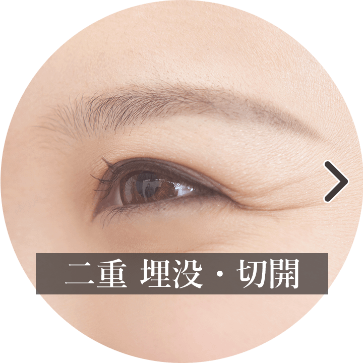 二重