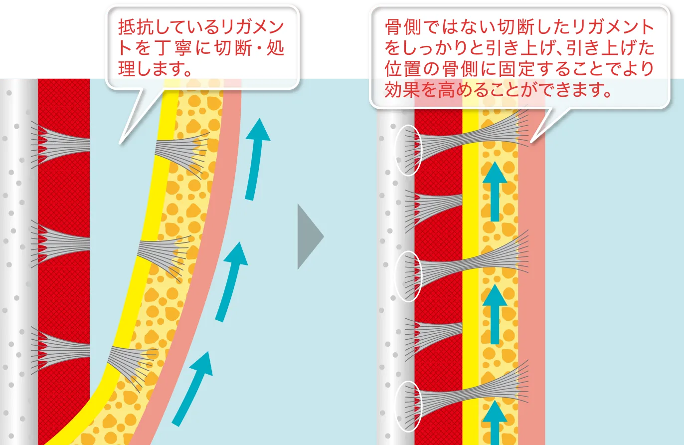 イメージ2