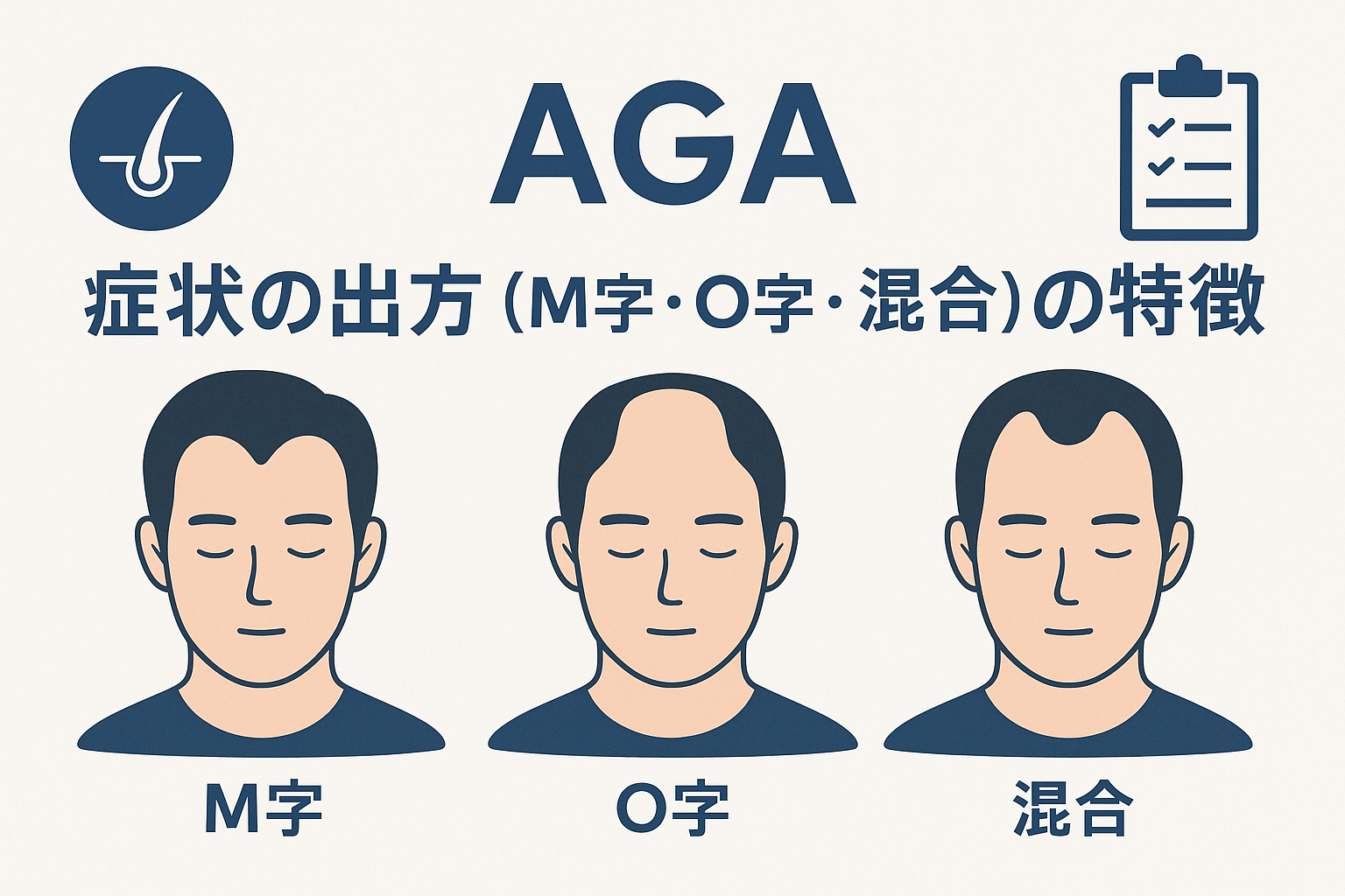 AGA 症状の出方（M字・O字・混合）の特徴