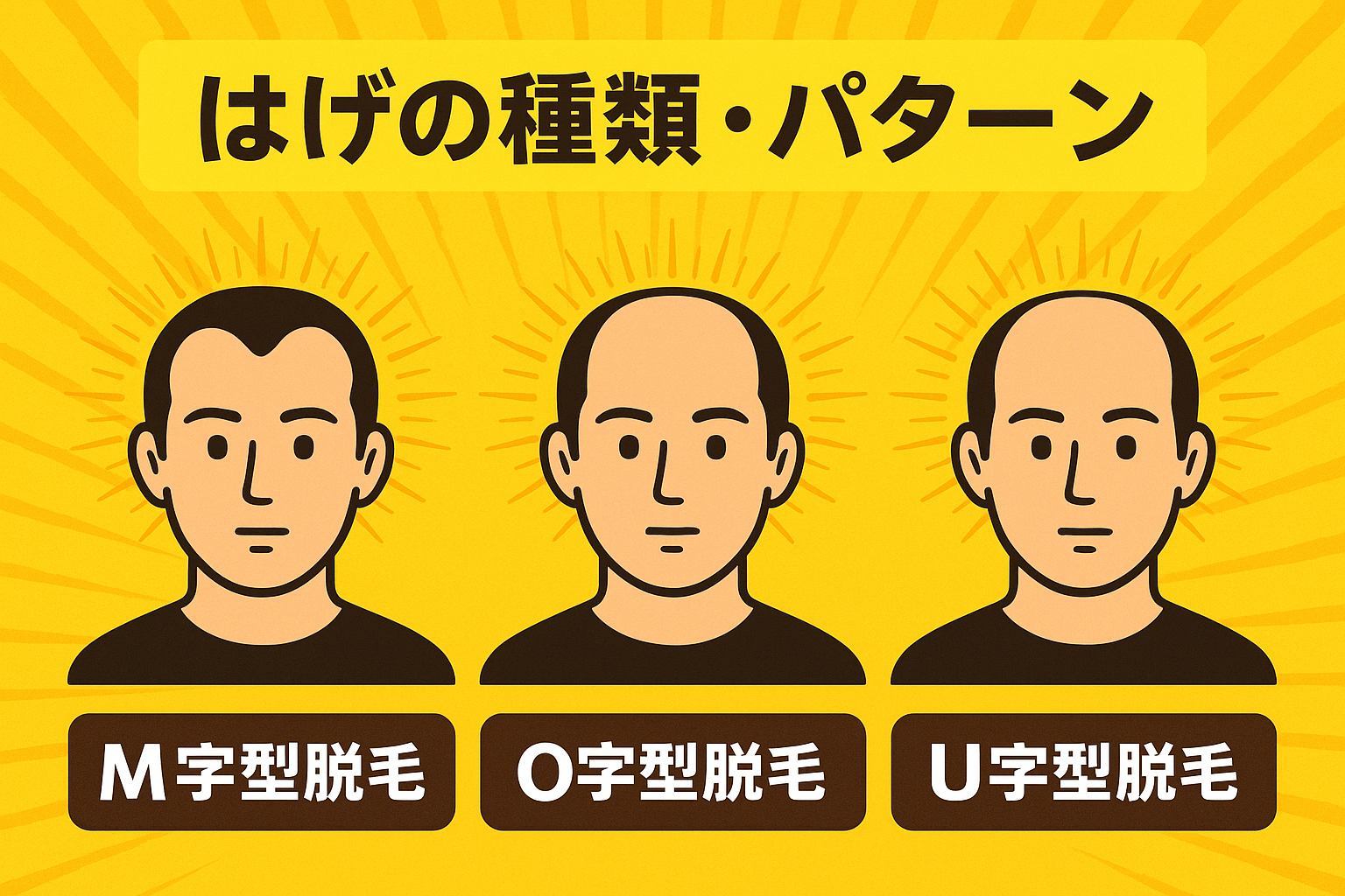 はげ（薄毛）の種類は3つ！画像とともに原因や対策を解説！ | 【公式】S.T style クリニック | 美容外科・美容皮膚科・婦人科形成 ...