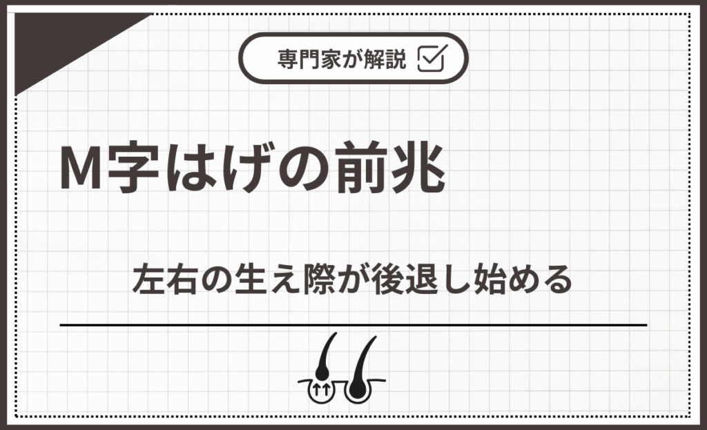 M字はげの前兆①左右の生え際が後退し始める