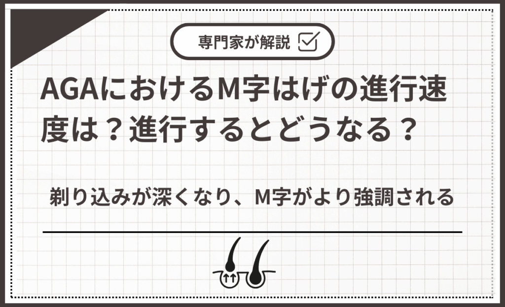 剃り込みが深くなり、M字がより強調される