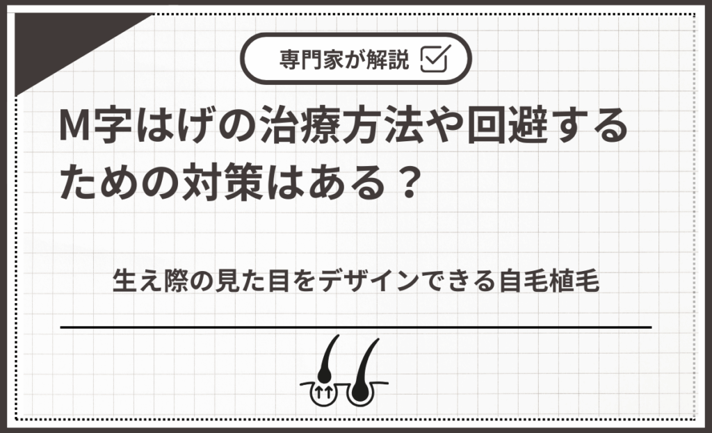 生え際の見た目をデザインできる自毛植毛