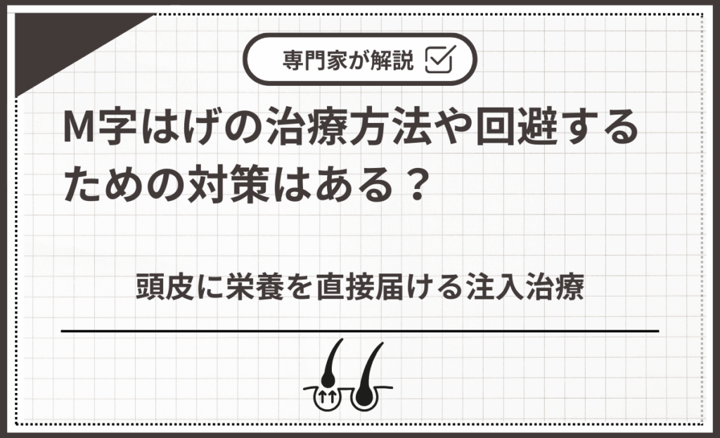 頭皮に栄養を直接届ける注入治療
