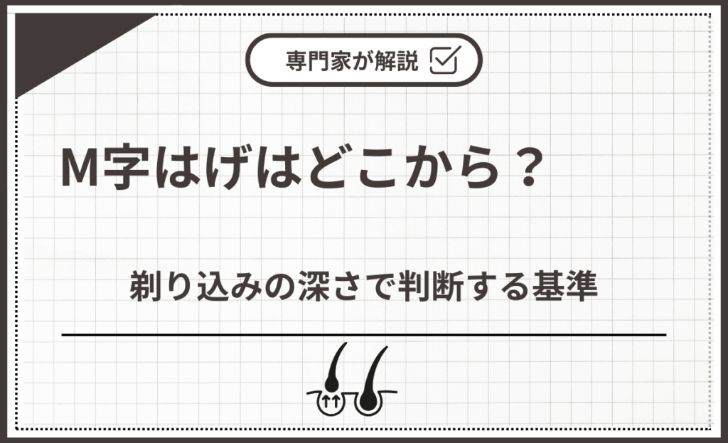 剃り込みの深さで判断する基準