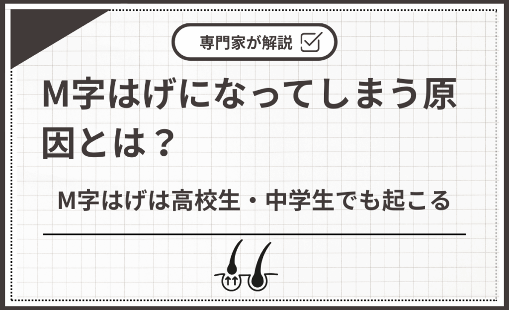 M字はげは高校生・中学生でも起こる