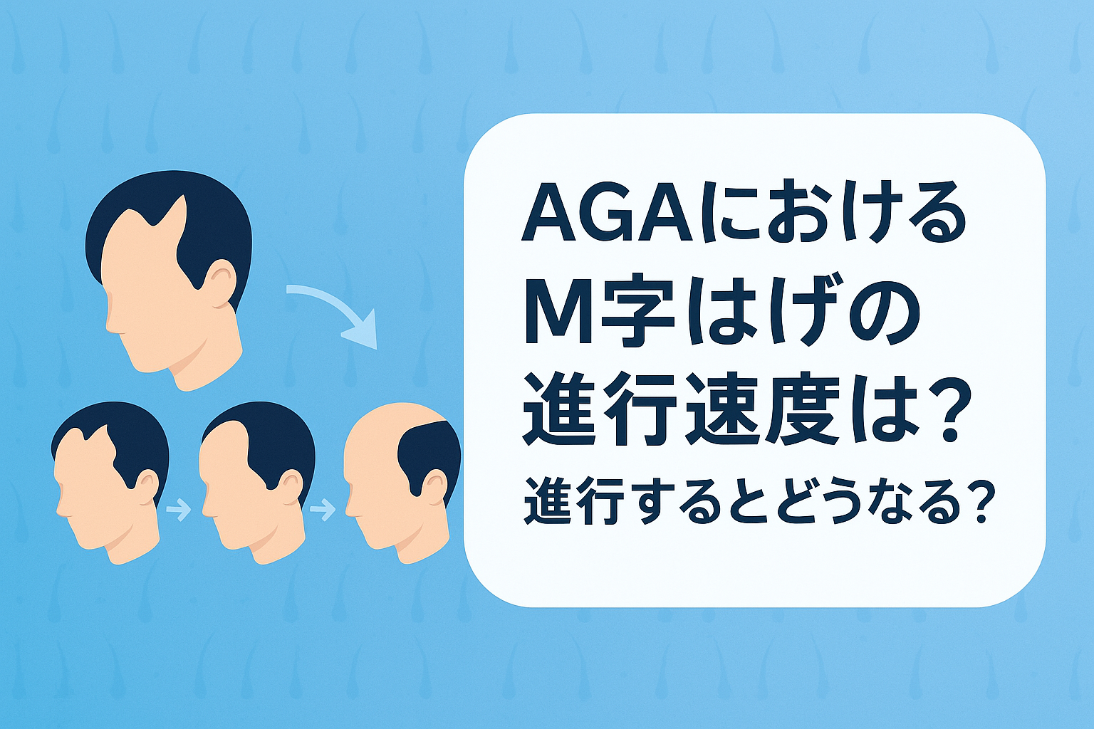AGAにおけるM字はげの進行速度は？進行するとどうなる？