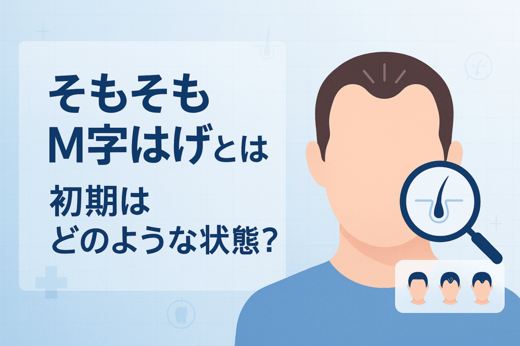 そもそもM字はげとは？初期はどのような状態？
