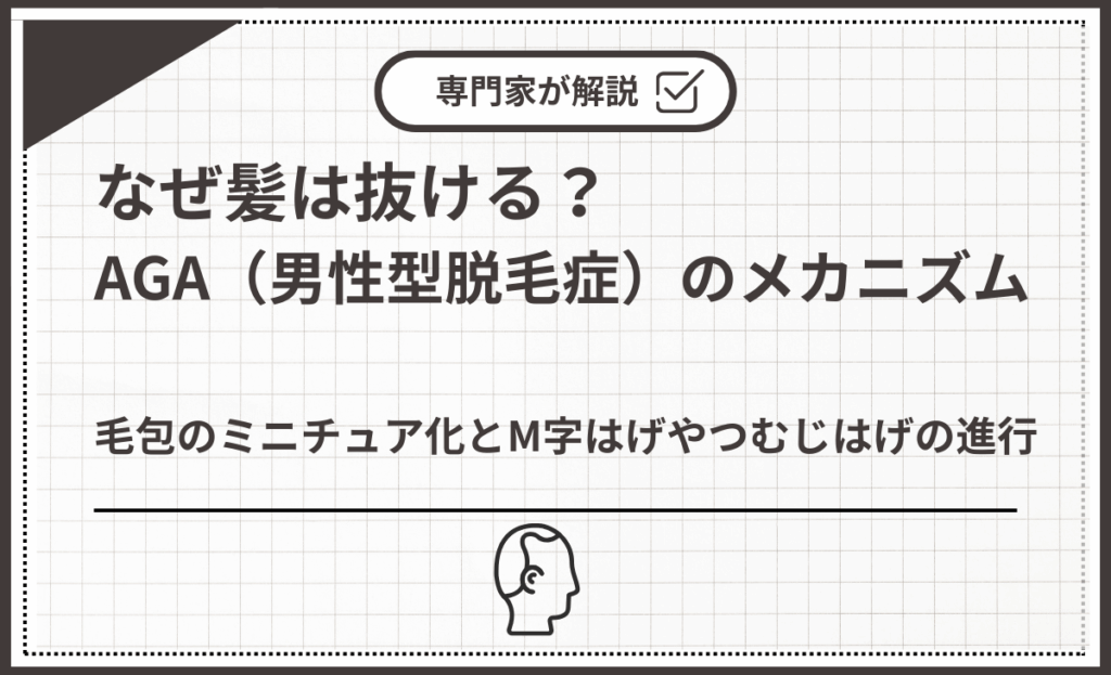 毛包のミニチュア化とM字はげやつむじはげの進行