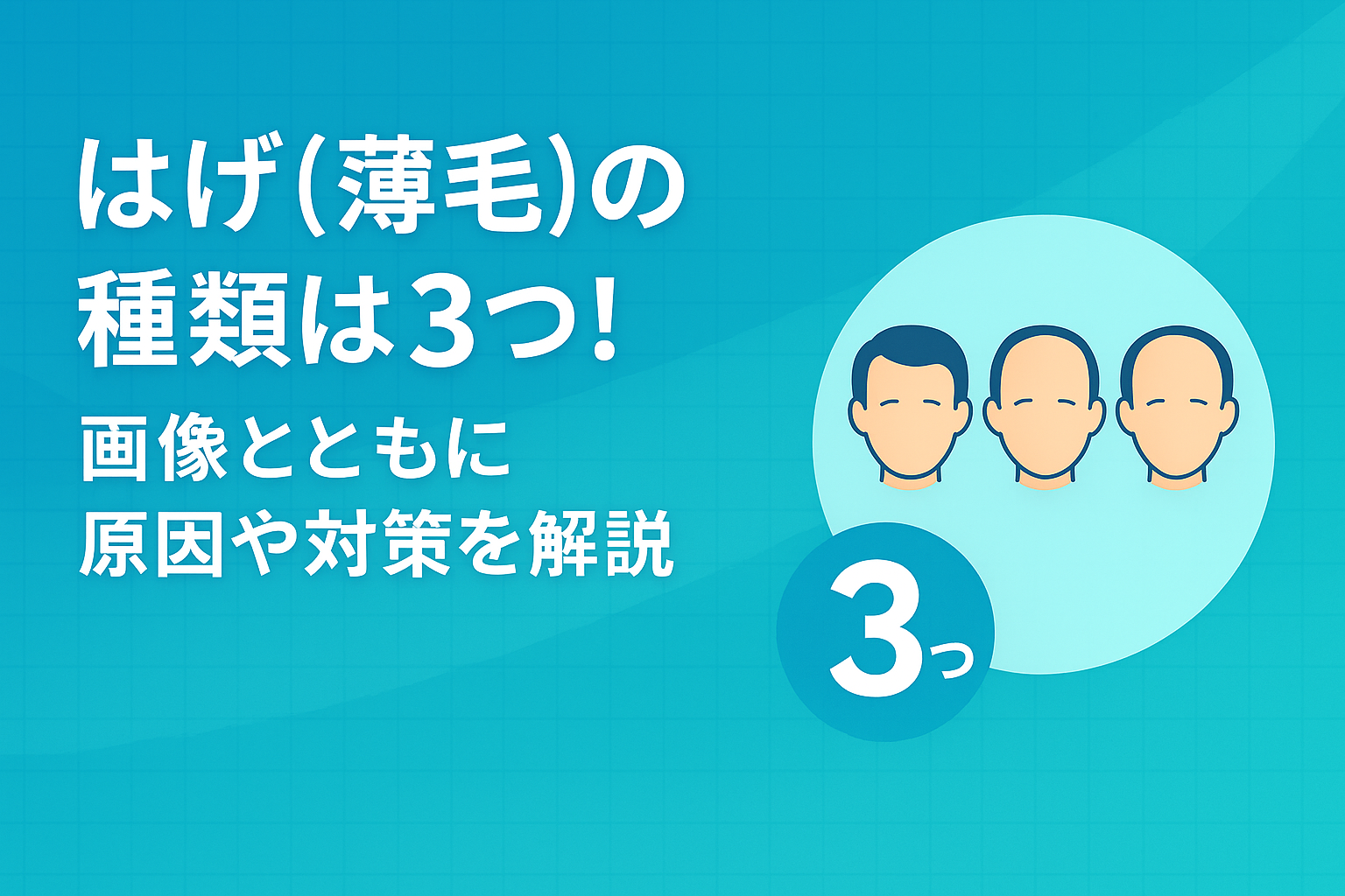 はげ（薄毛）の種類は3つ！画像とともにに原因や対策を解説！