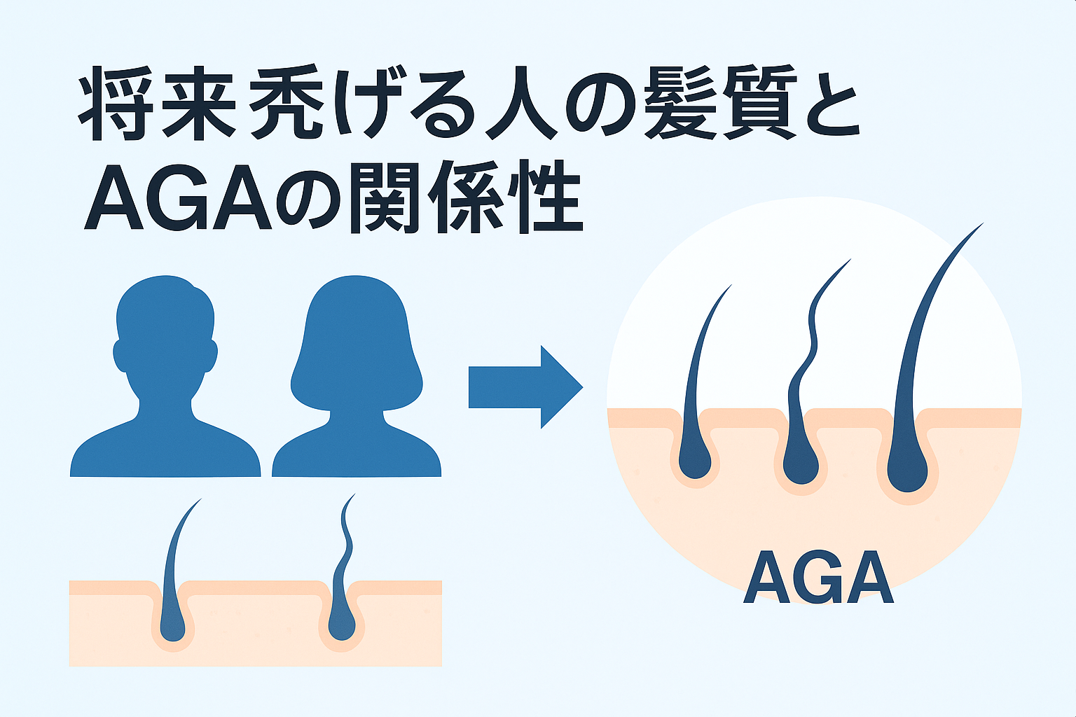 将来禿げる人の髪質とAGAの関係性