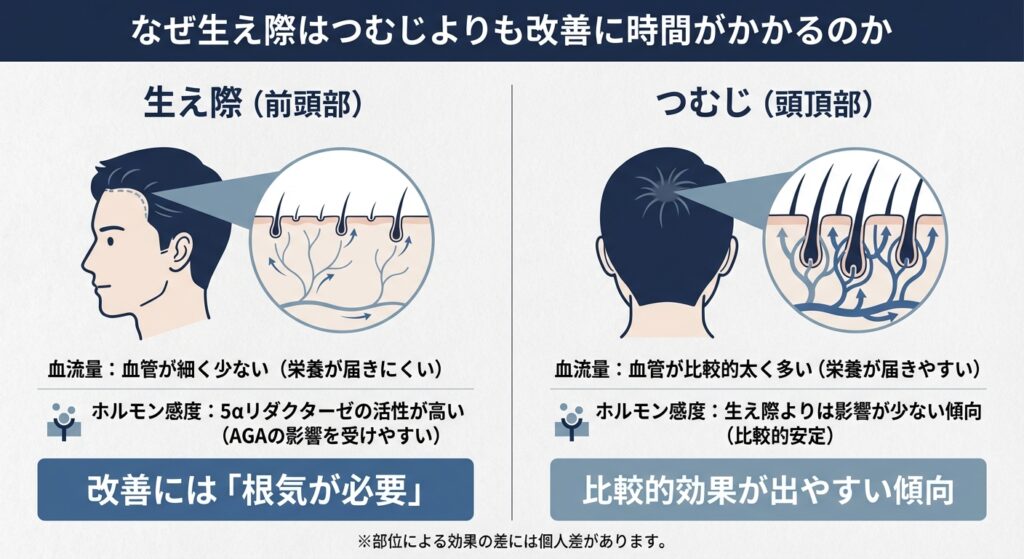 なぜ生え際はつむじよりも改善に時間がかかるのか