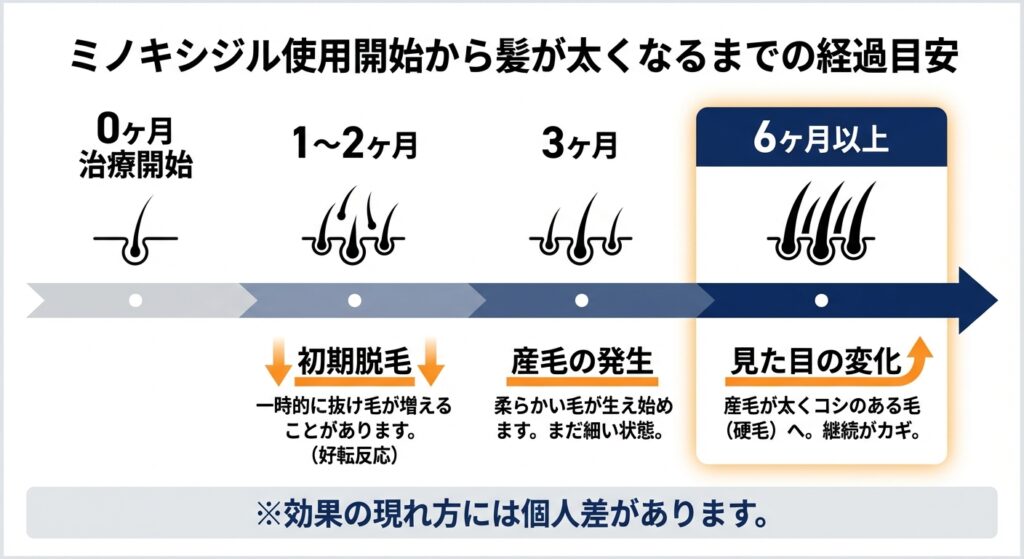 ミノキシジル使用開始から髪が太くなるまでの経過目安