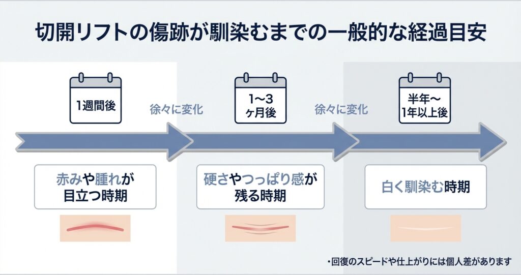 切開リフトの傷跡が治るまでの具体的な経過目安