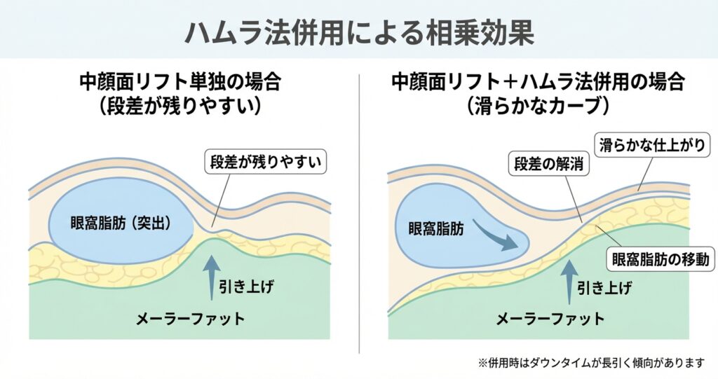 中顔面リフトとハムラ法(裏ハムラ法)の併用による相乗効果