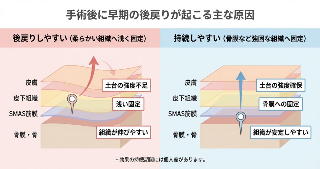 ミッドフェイスリフトの手術後に後戻りを感じる原因
