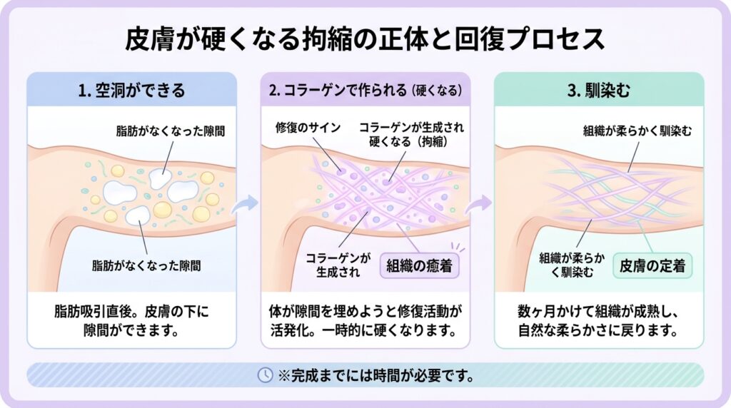 皮膚が固くなる拘縮の正体と回復プロセス