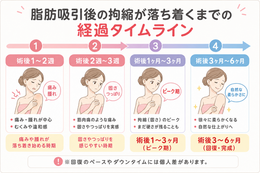 脂肪吸引後の拘縮が落ち着くまでの経過タイムライン