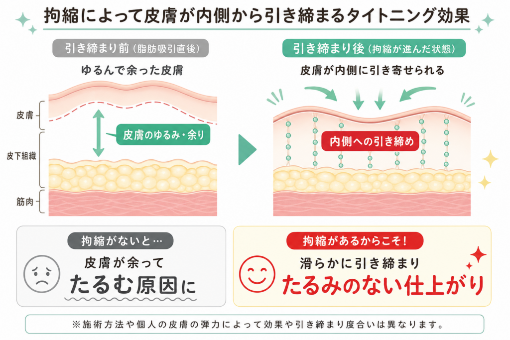 拘縮によって皮膚が内側から引き締まるタイトニング効果