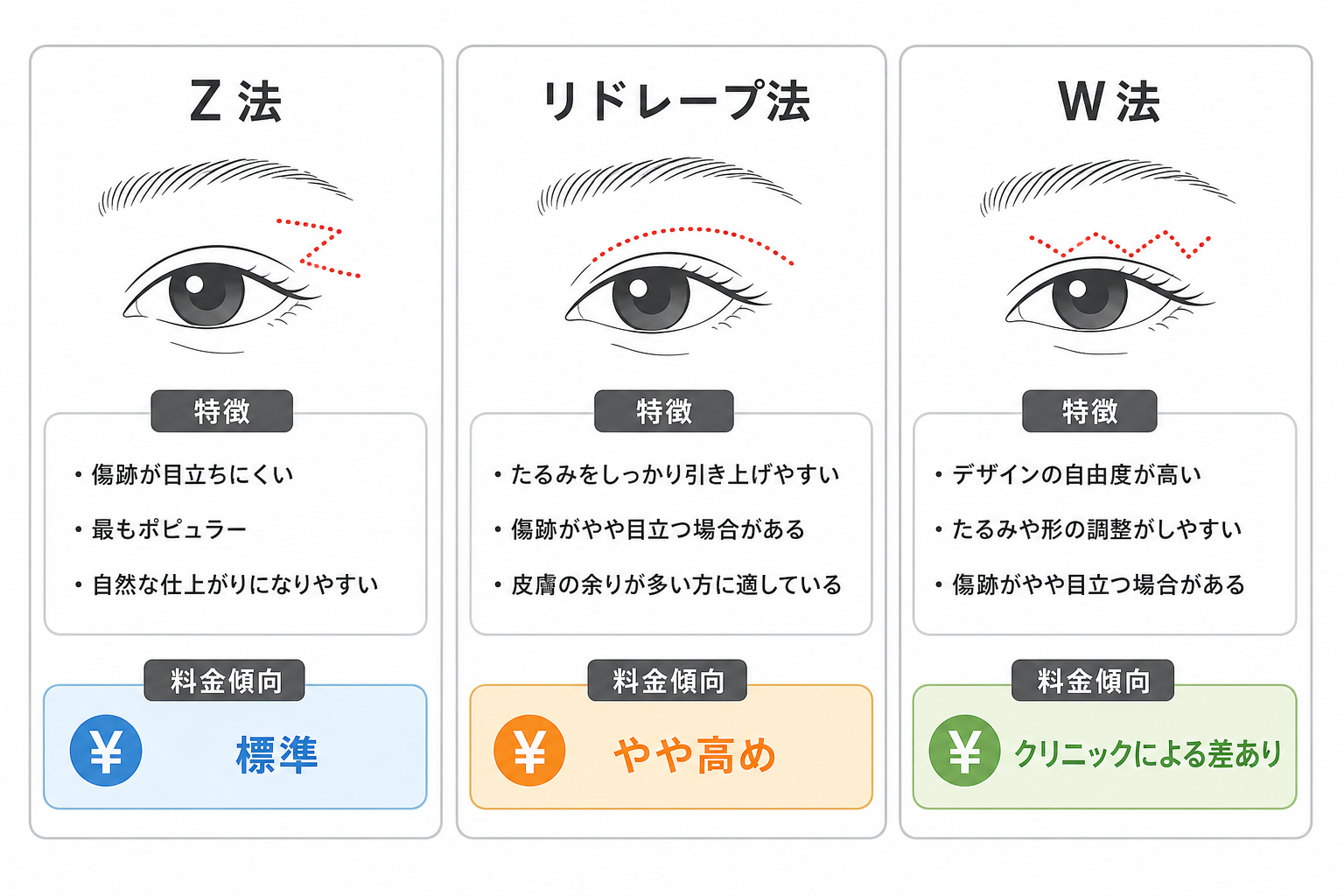 術式（Z法・リドレープ法・W法）による価格の違い