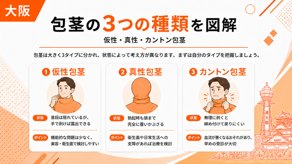 仮性包茎、真性包茎、カントン包茎の3つの種類の違いの図解画像
