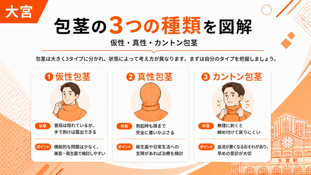 仮性包茎、真性包茎、カントン包茎の3つの種類の違いの図解画像