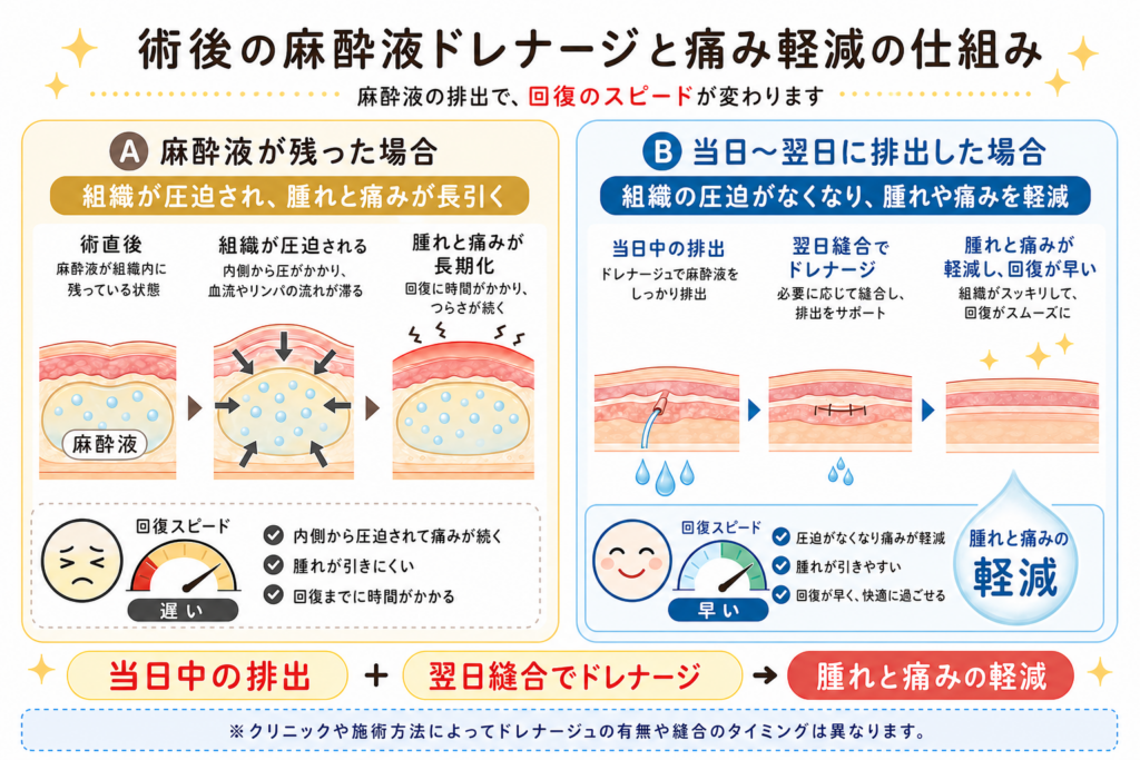 術後の麻酔駅ドレナージュと痛み軽減の仕組み