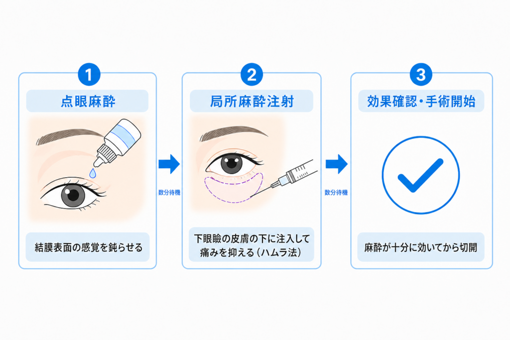 点眼麻酔を先行させてから注射する流れ